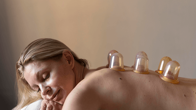 Cupping Therapy