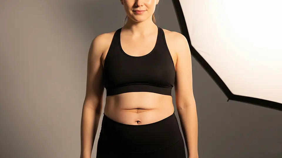 What Diastasis Recti Actually is (and Why That Matters)