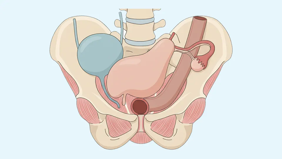 Pregnancy and postpartum physiotherapy internal examination